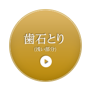 歯石とり (浅い部分) 