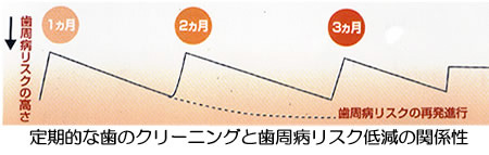 ホワイトエッセンス式クリーニング